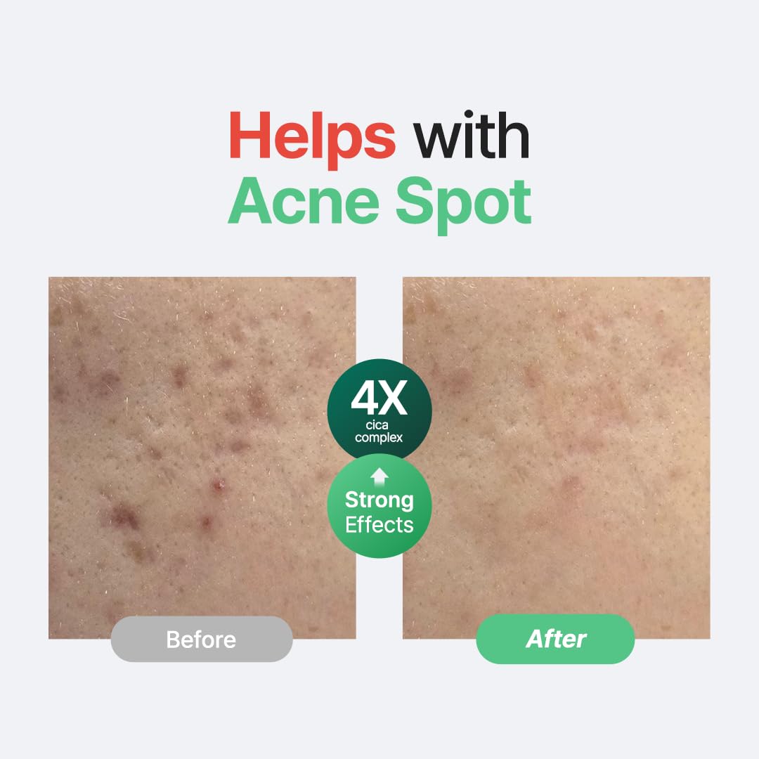 Purito Seoul Wonder Relief Centella Serum Unscented 60ml