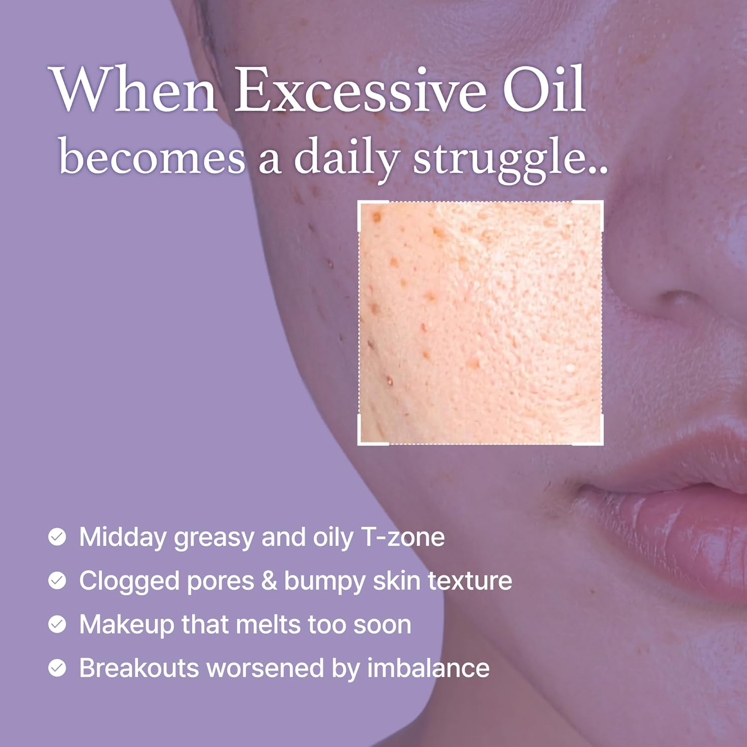 I'm From Black Rice Toner 150ml