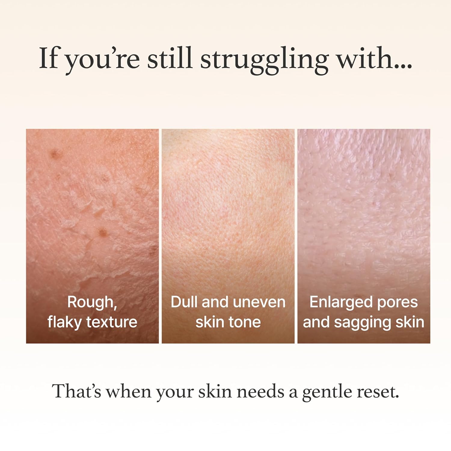 I'm From Rice Mask 110g