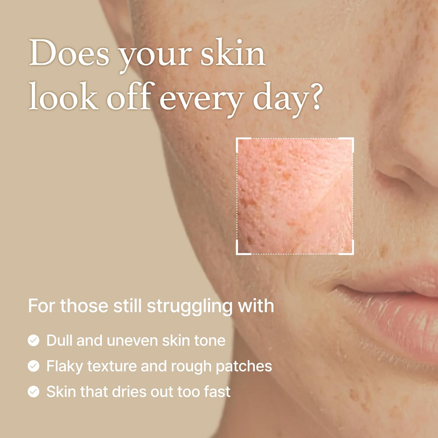 I'm From Rice Toner 30ml