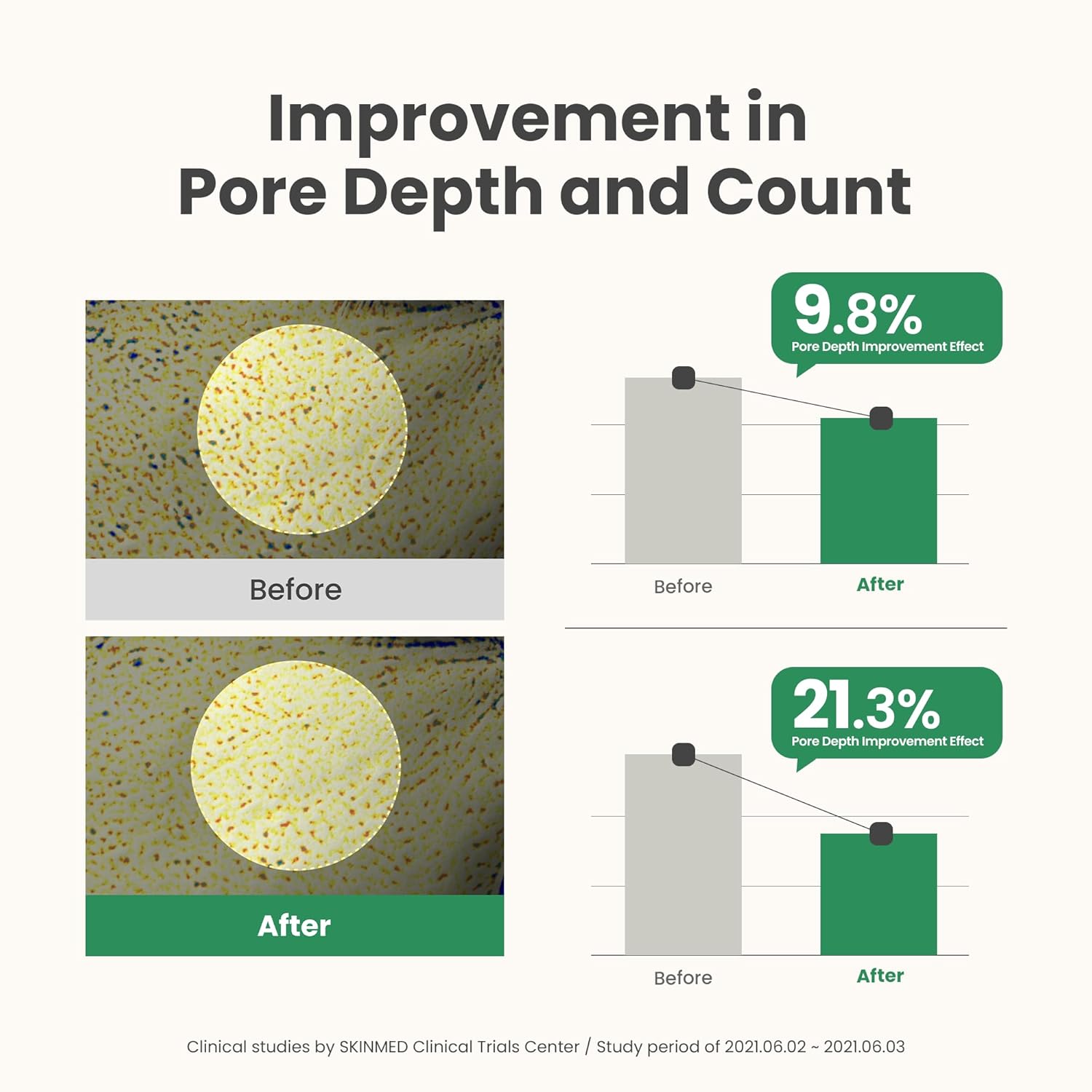 Axis - Y Mugwort Pore Clarifying Wash Off Pack - 100ml