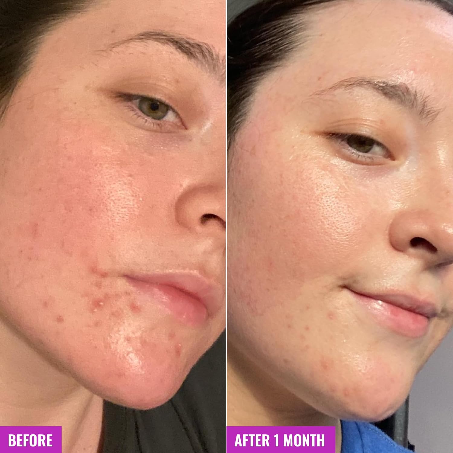 Good Molecules Clarify & Cleansing Bar