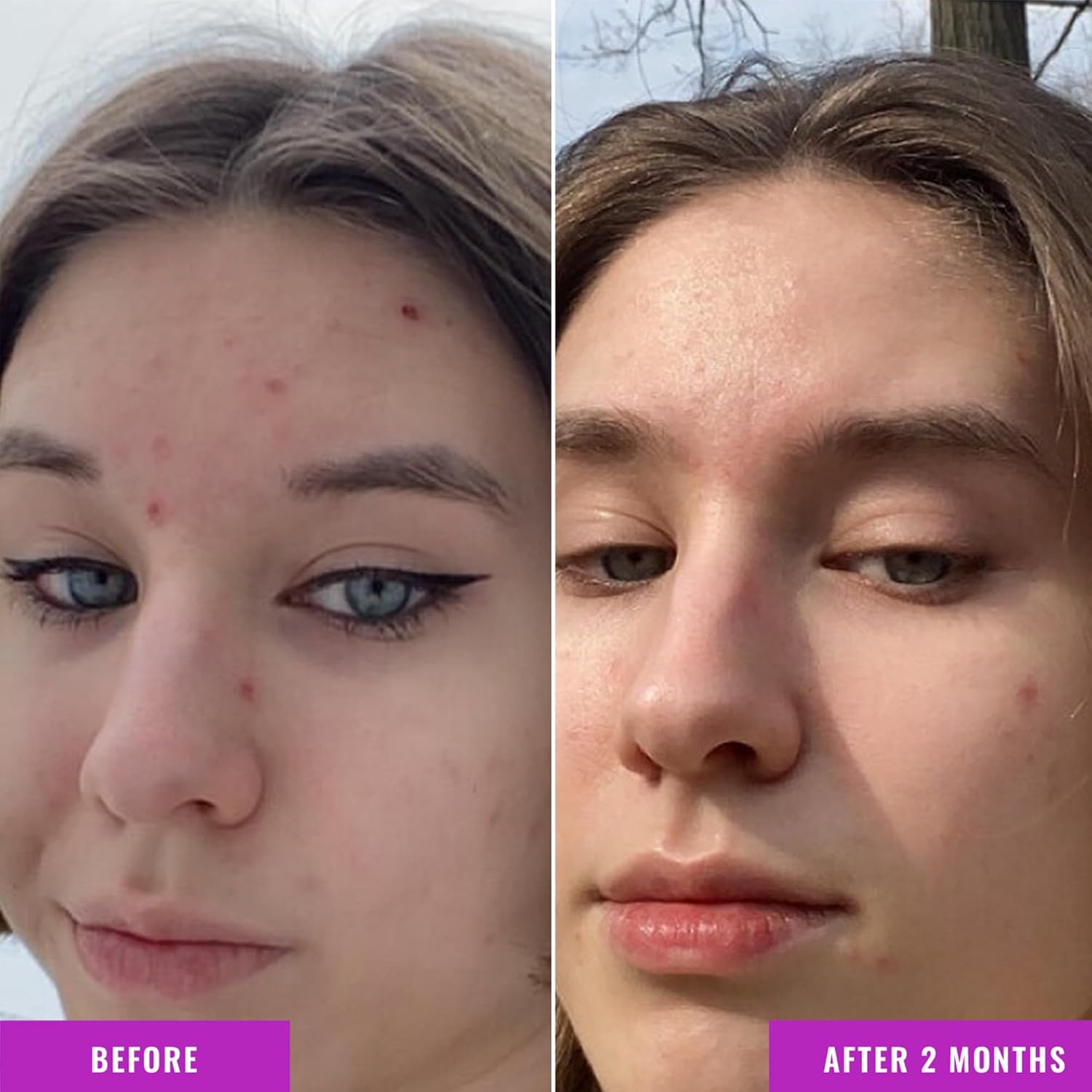 Good Molecules Niacinamide Serum 75ml (Jumbo Size)