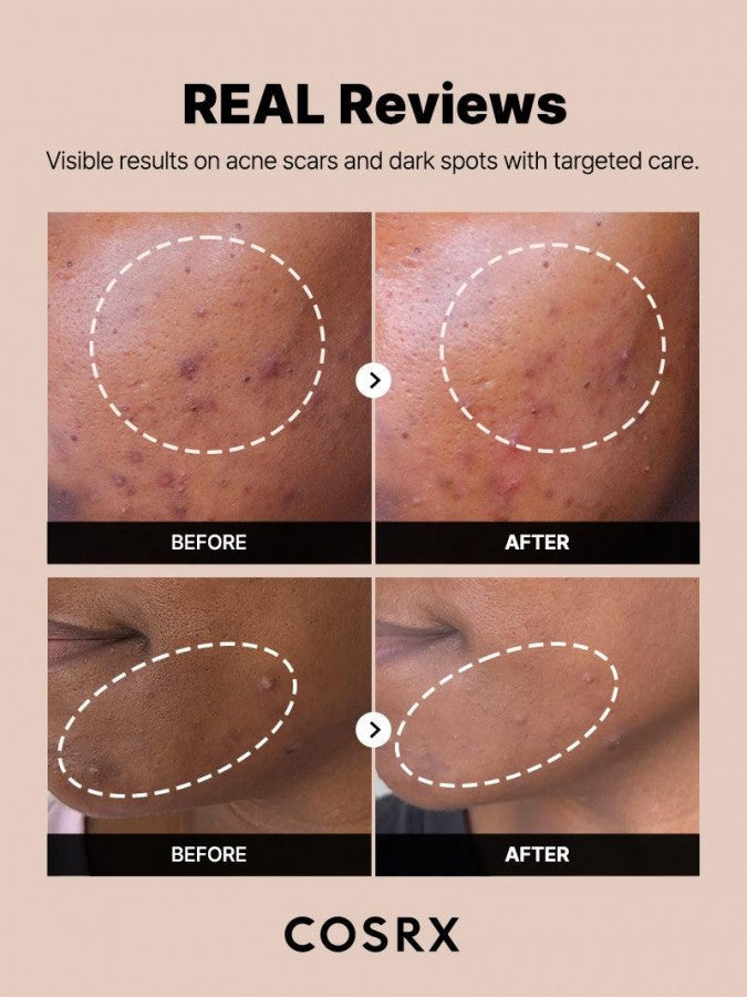 Cosrx The Alpha Arbutin 2 Discoloration Care Serum 50ml