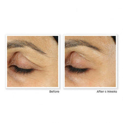 Roc Retinol Correction Line Smoothing Eye Cream