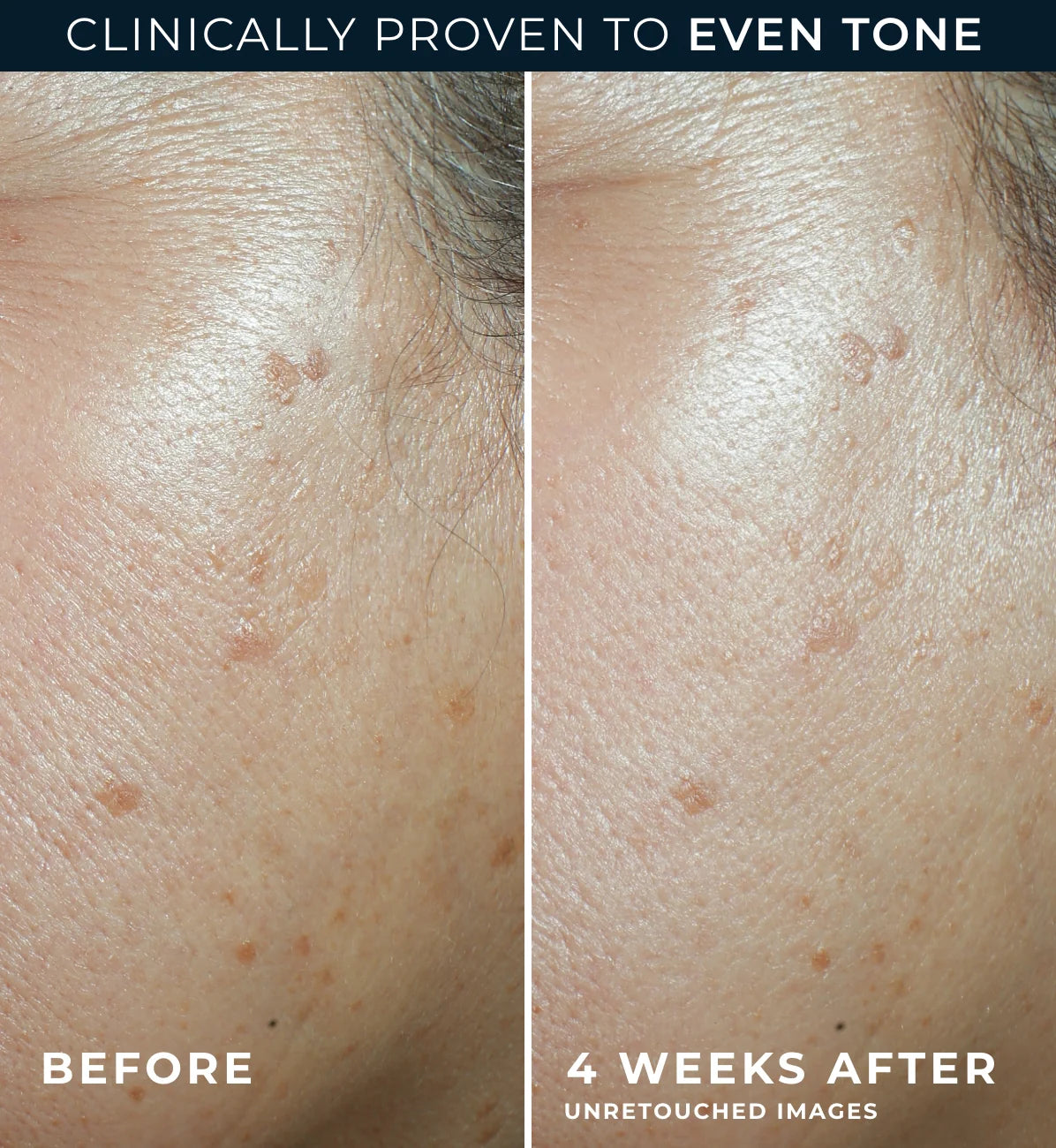 Roc Multi Correxion Even Tone +Lift Daily Moisturizer Spf 30