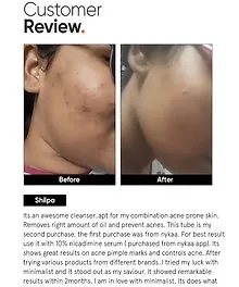 Salicylic Acid + LHA 2% Cleanser1.webp
