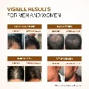 Advanced Hair Growth Serum With 3% Redensyl, 4% Anagain, & 1% Capilia Longa - 30 ml4.webp